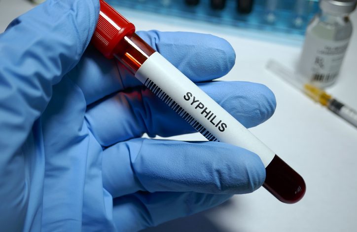 La sífilis es una infección de transmisión sexual (ITS) que se transmite más fácilmente cuando se toca una lesión de sífilis durante las relaciones sexuales.
