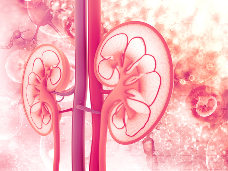 Todo lo que debes saber sobre el cáncer de células renales