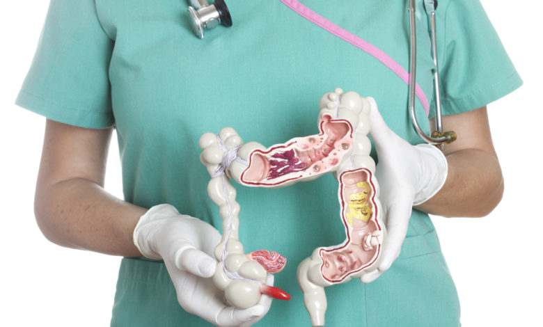 Conoce todo sobre la enfermedad de Crohn