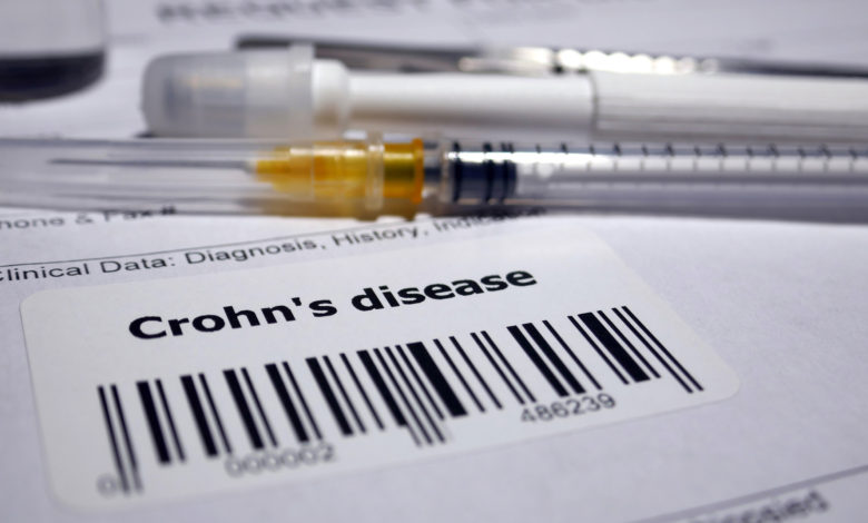 Opciones de tratamiento de la enfermedad de Crohn