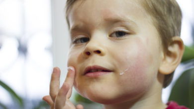 Todo lo que necesitas saber sobre la dermatitis atópica