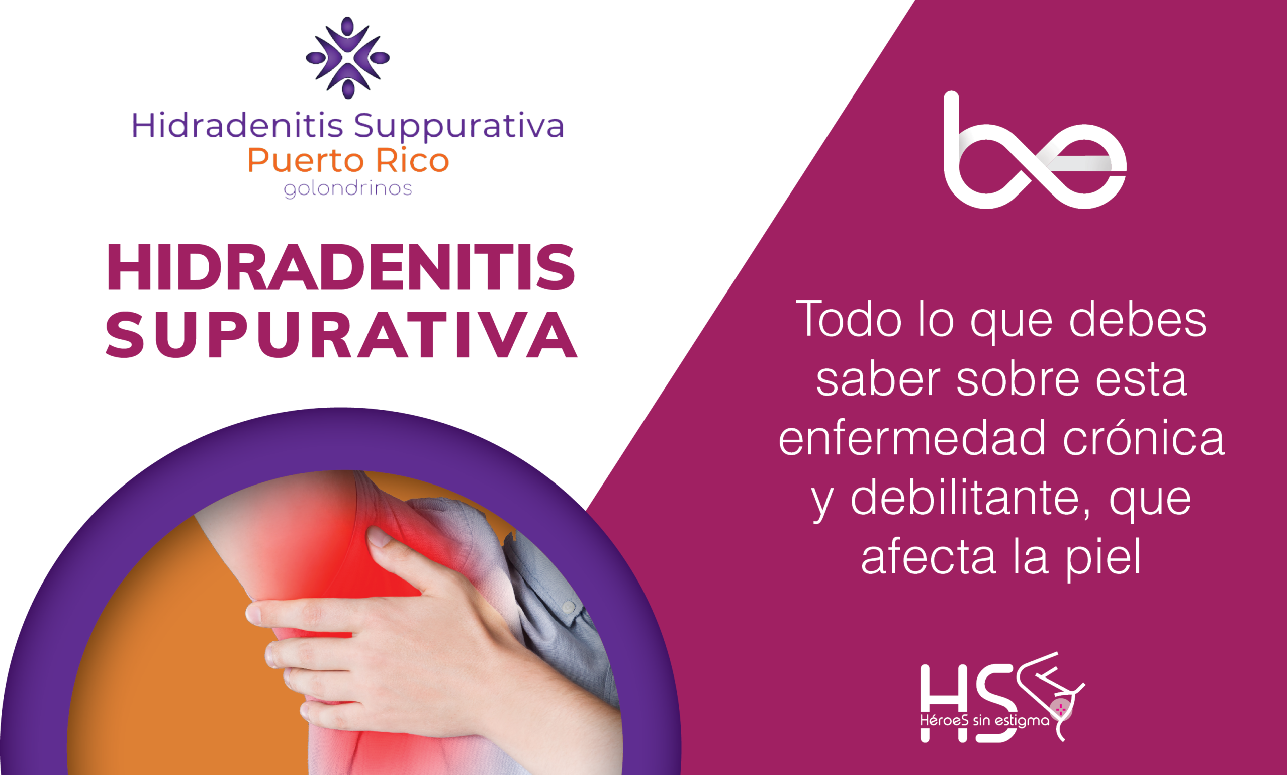 Día Mundial de la Hidradenitis Supurativa