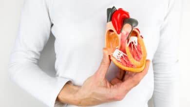 Todo lo que necesitas saber sobre el Bypass coronario