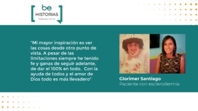 Veinticinco años viviendo con esclerodermia: la historia de Glorimer