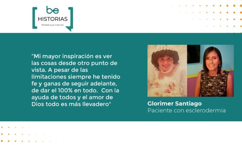 Veinticinco años viviendo con esclerodermia: la historia de Glorimer