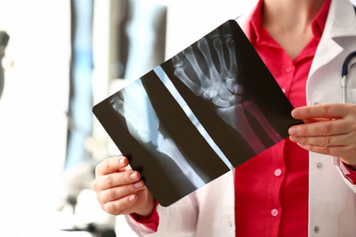 Doctora con radiografía