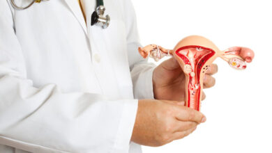 Tipos de cáncer de ovarios y sus causas