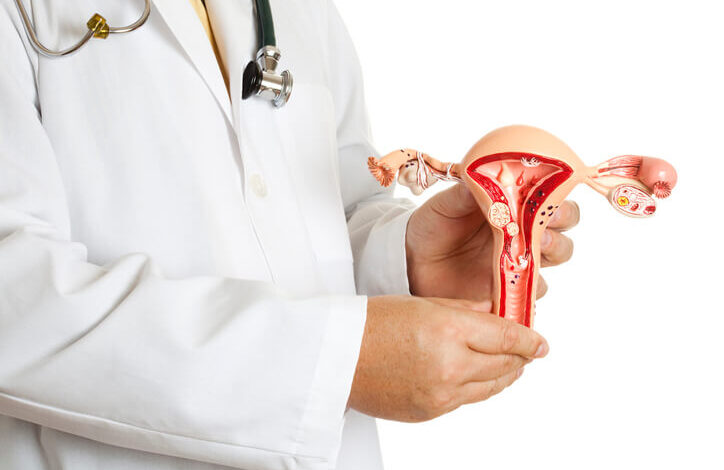 Tipos de cáncer de ovarios y sus causas
