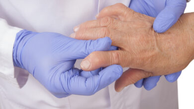 Diagnóstico y tratamientos para la artritis reumatoide