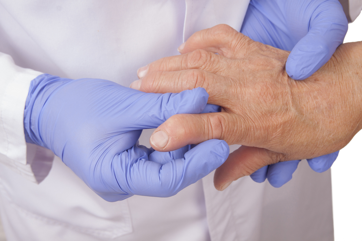 Diagnóstico y tratamientos para la artritis reumatoide