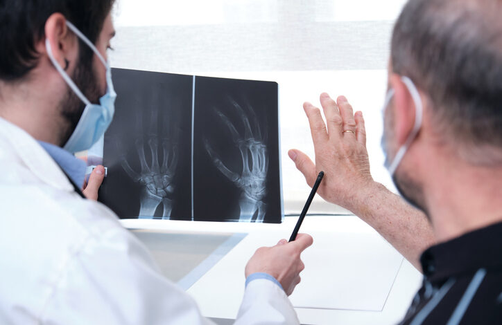 Cuáles son las principales complicaciones desencadenadas por la artritis reumatoide
