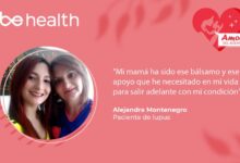 Vivir con lupus