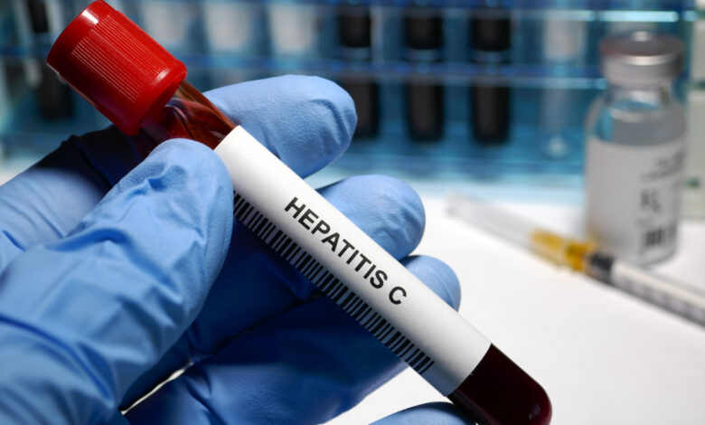Hepatitis C: todo lo que debes saber