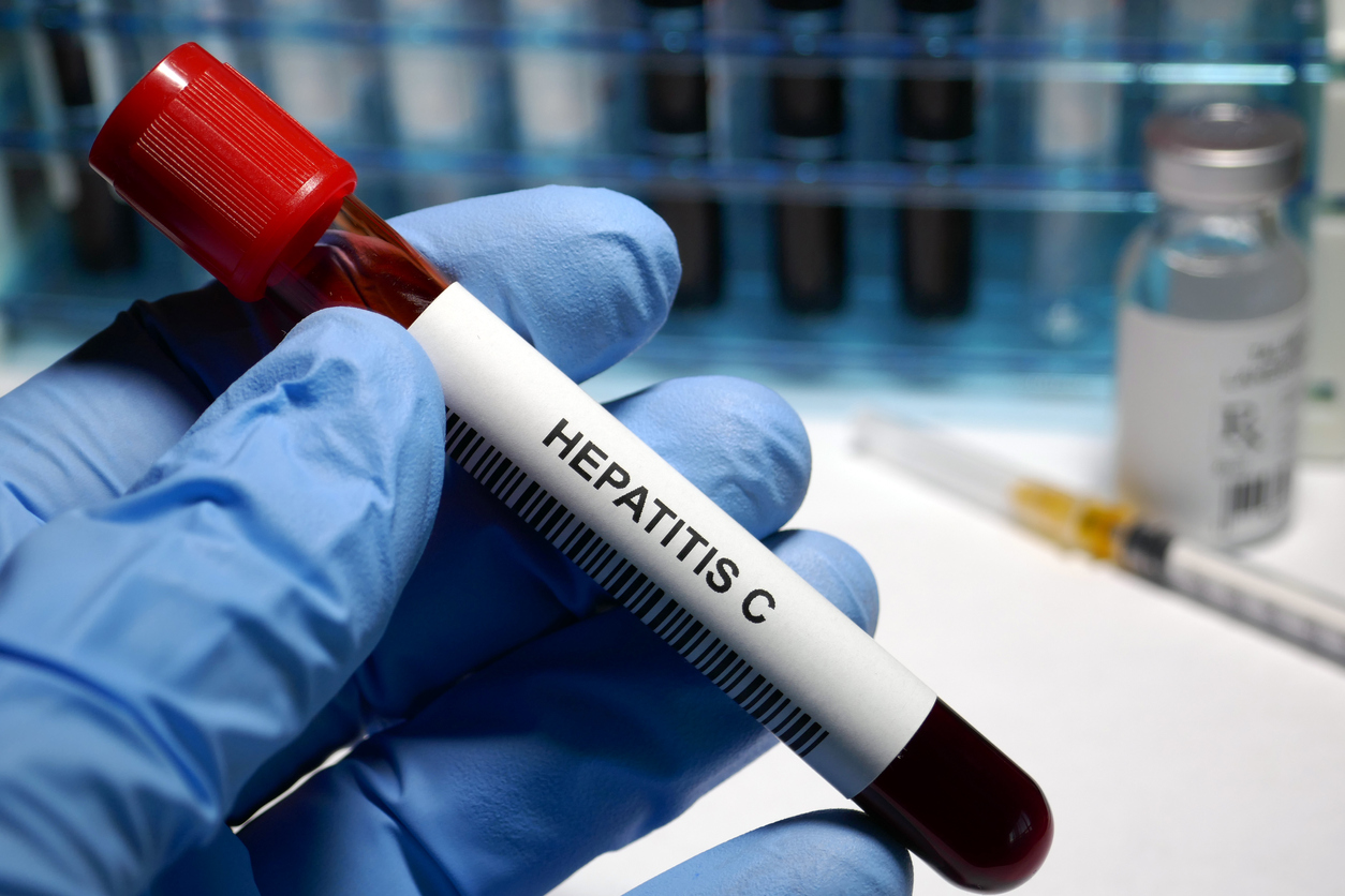 Hepatitis C: todo lo que debes saber