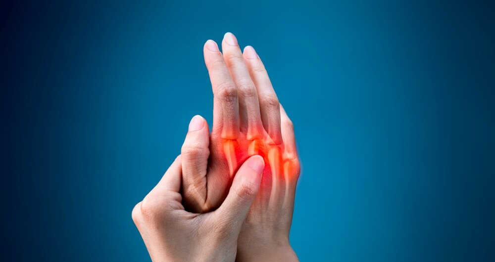 La artritis reumatoide se refleja mediante la inflamación en las articulaciones.