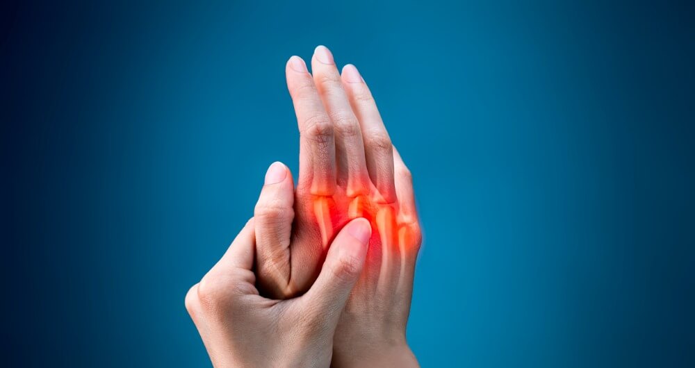 La artritis reumatoide se refleja mediante la inflamación en las articulaciones.