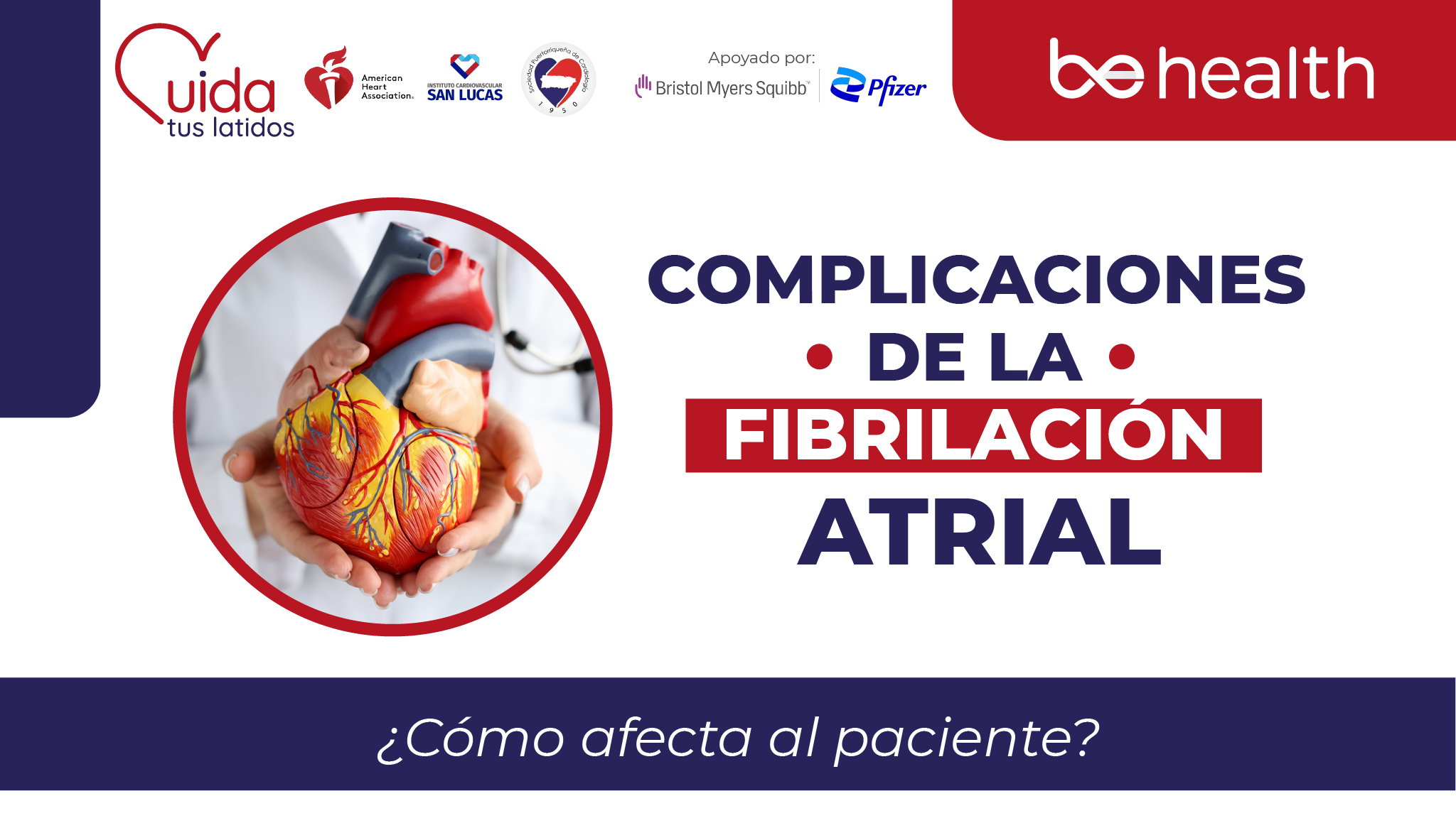 ¿Qué complicaciones se puede presentar si sufro de FIBRILACIÓN ATRIAL?