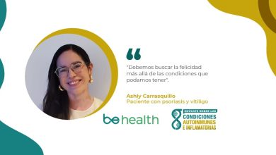 Ashly Carrasquillo, joven boricua que fue diagnosticada con psoriasis y vitíligo