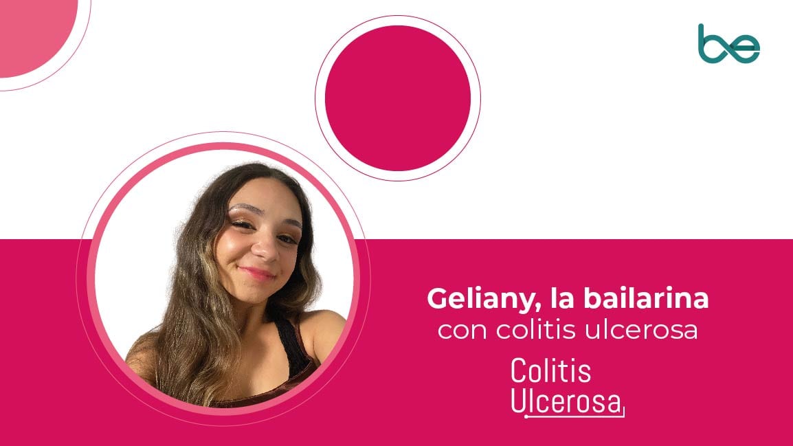 Geliany, una bailarina con colitis ulcerosa