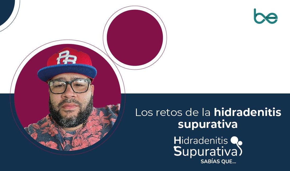 Los retos de la hidradenitis supurativa