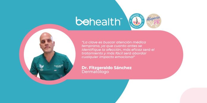 Con la alopecia, la clave es buscar atención médica temprana