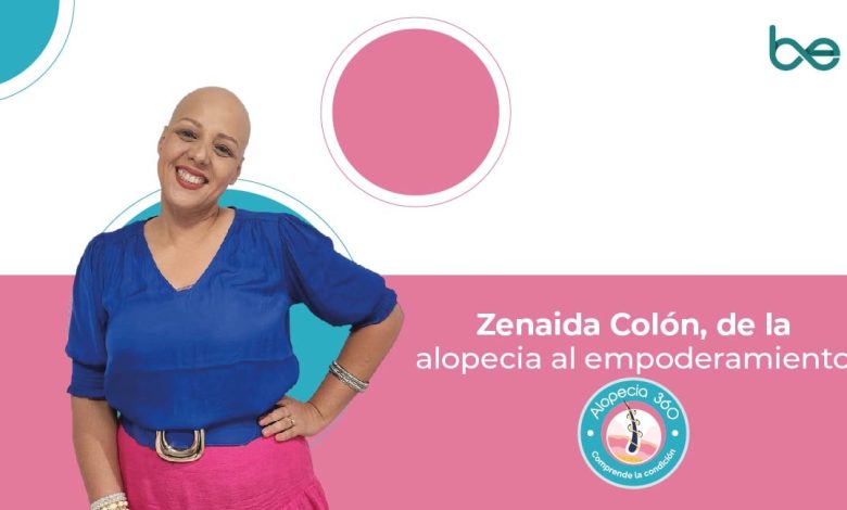 Zenaida Colón, de la alopecia al empoderamiento