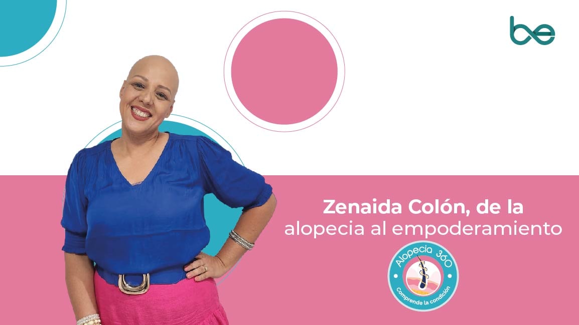 Zenaida Colón, de la alopecia al empoderamiento