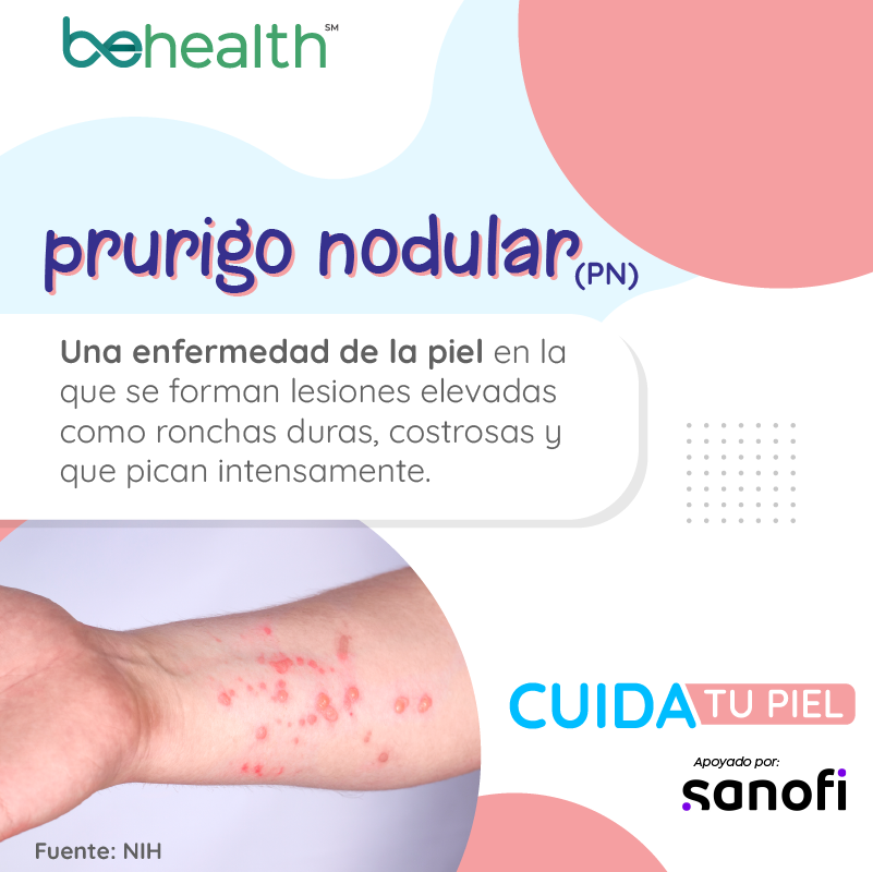 CTP_pieza-20