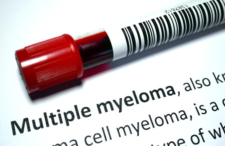 Las personas con amiloidosis combinada con mieloma múltiple tienen una expectativa de vida más corta en general.