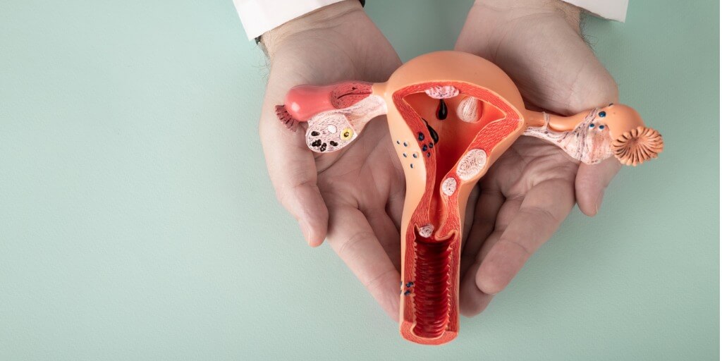 Según la Organización Mundial de la Salud (OMS), La endometriosis afecta aproximadamente a 190 millones de mujeres y niñas en edad reproductiva en todo el mundo, es decir, a cerca del 10 % de este grupo poblacional.