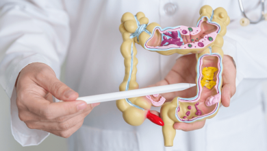 Etapas y evolución de la enfermedad de Crohn