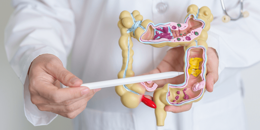 Etapas y evolución de la enfermedad de Crohn