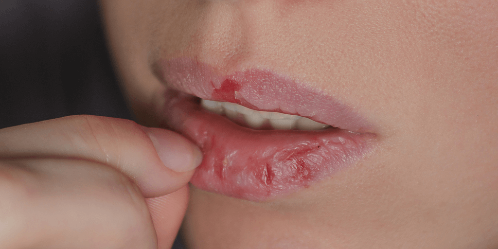 Artritis e injerencia de sequedad bucal
