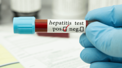 Hepatitis