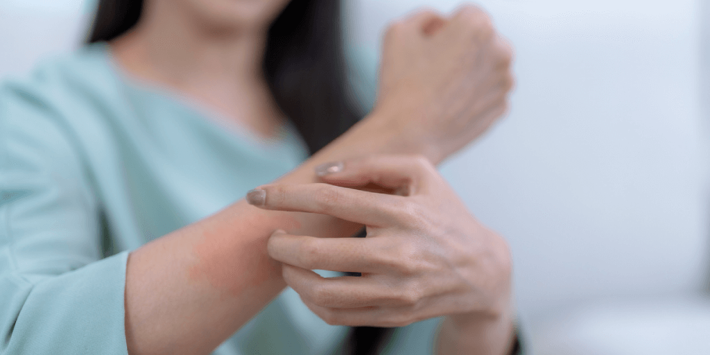 ¿Tienes psoriasis?: Atención a este tipo de medicamentos