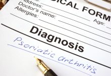Se estima que aproximadamente el 30% de los pacientes diagnosticados con psoriasis en la isla desarrollarán artritis psoriásica en algún momento de sus vidas.