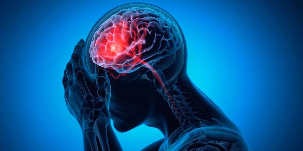Accidente cerebrovascular: conoce las nuevas recomendaciones para prevenirlos