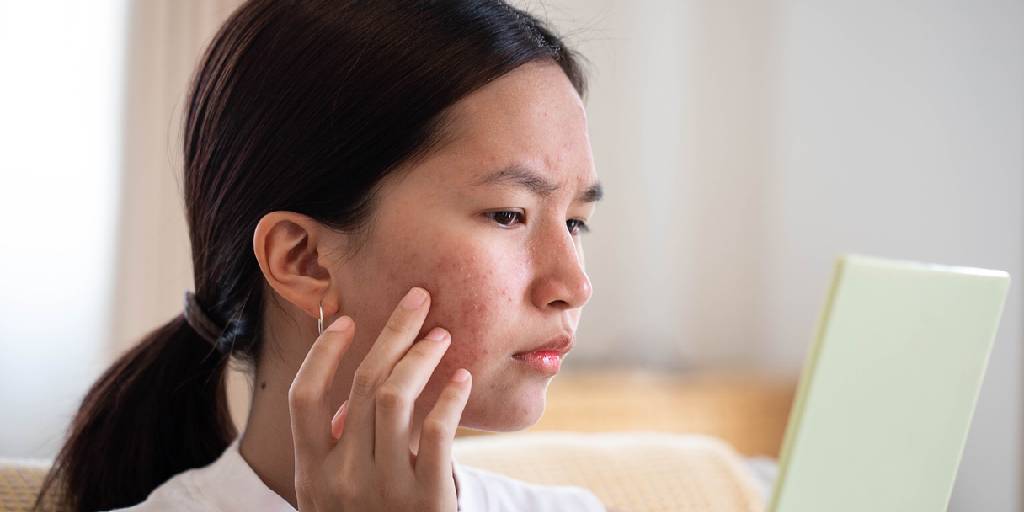 ¿Cara cortisol? un término que seguro no conoces, pero es la nueva obsesión de las redes