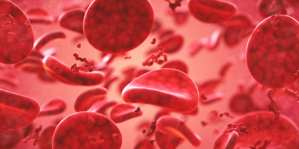Anemia
