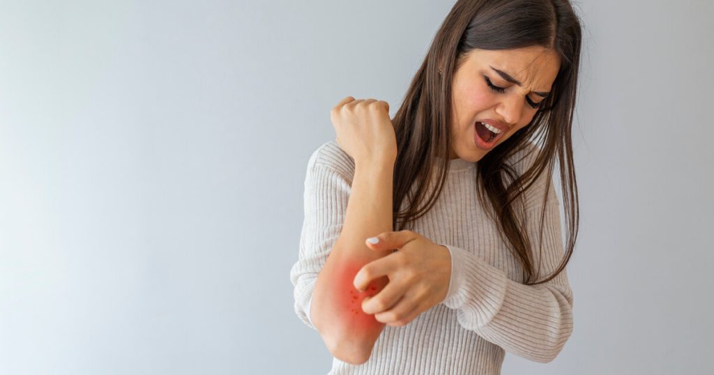 Vivir con psoriasis: Todo lo que debes saber sobre la enfermedad
