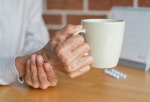 En un avance que podría cambiar la historia del tratamiento del Parkinson, un equipo médico en Estados Unidos ha iniciado un ensayo clínico pionero utilizando células madre obtenidas del propio paciente para reemplazar neuronas dañadas en el cerebro.