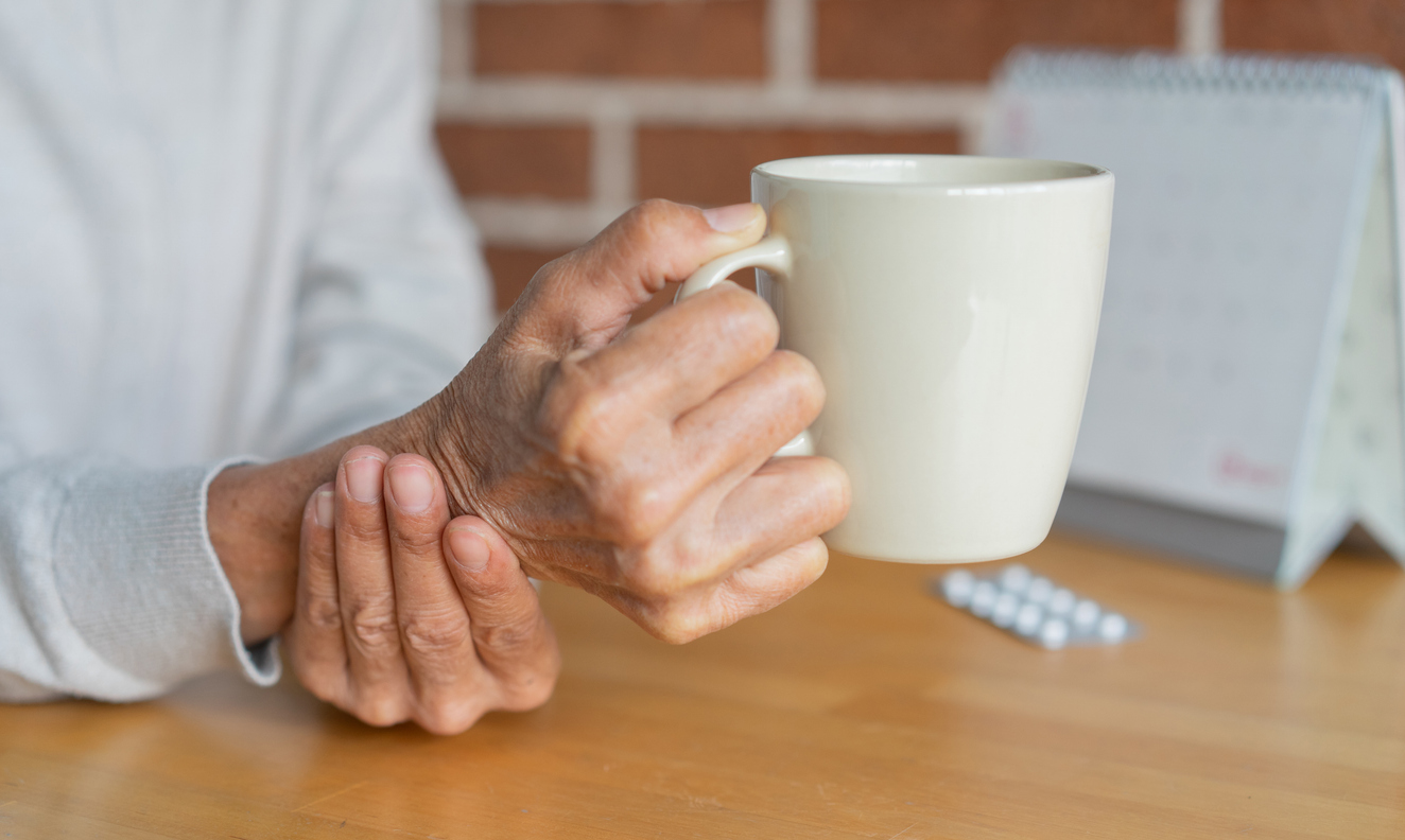 En un avance que podría cambiar la historia del tratamiento del Parkinson, un equipo médico en Estados Unidos ha iniciado un ensayo clínico pionero utilizando células madre obtenidas del propio paciente para reemplazar neuronas dañadas en el cerebro.