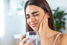 Conoce los problemas dentales más comunes