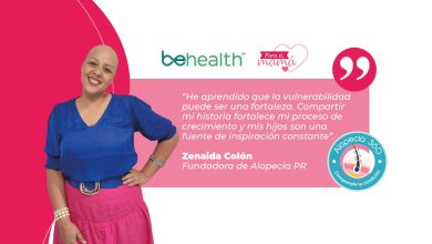 Alopecia