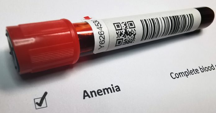 Anemia