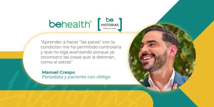Manuel Crespo y su vida con vitiligo