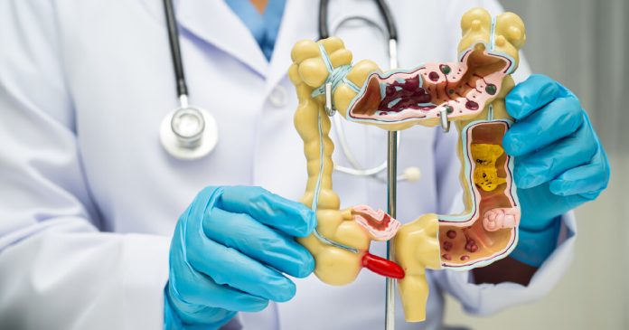 Microbiota