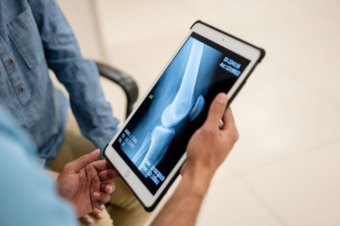 Cuándo es necesario una radiografía