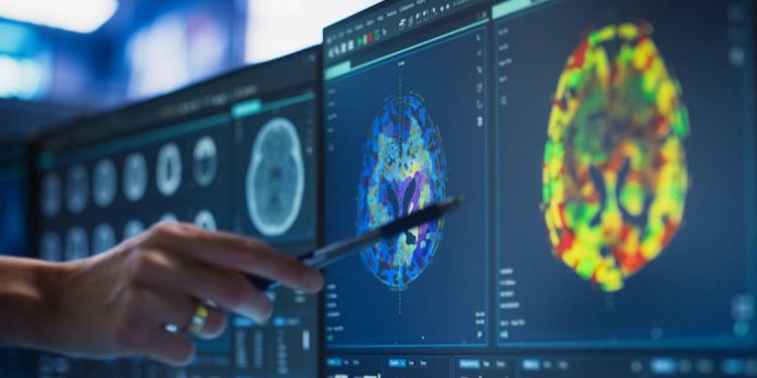 El síntoma más común son las convulsiones (epilepsia), que suelen comenzar en los primeros meses de vida.