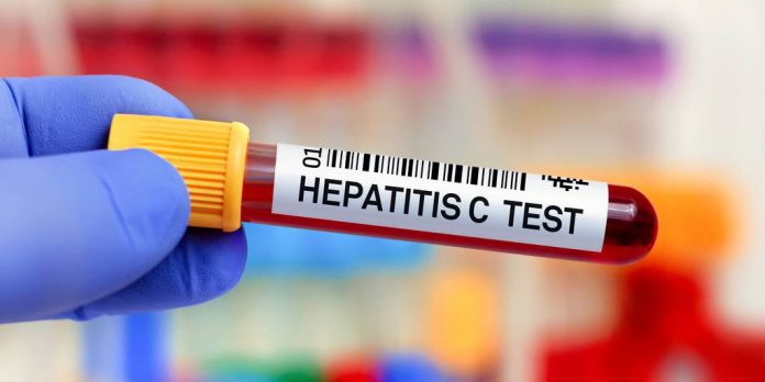 Hazte la prueba de la hepatitis C